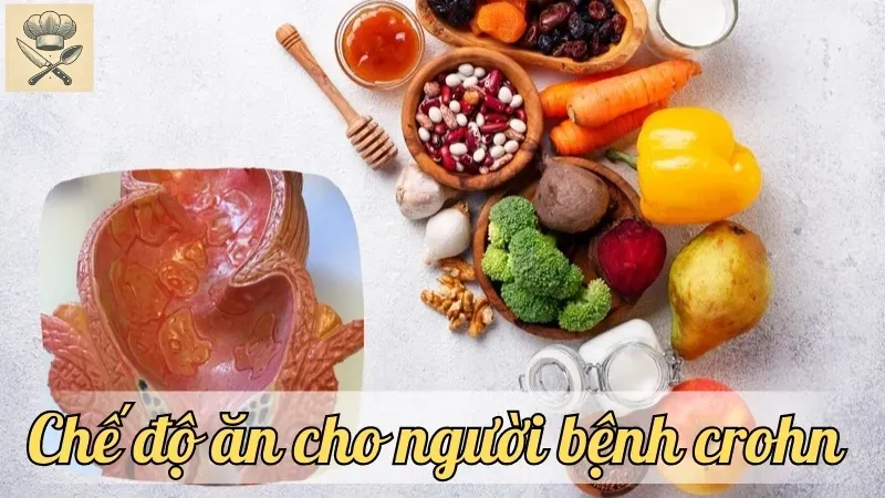 Chế độ ăn hợp lý giúp người bệnh crohn tăng cường sức khỏe