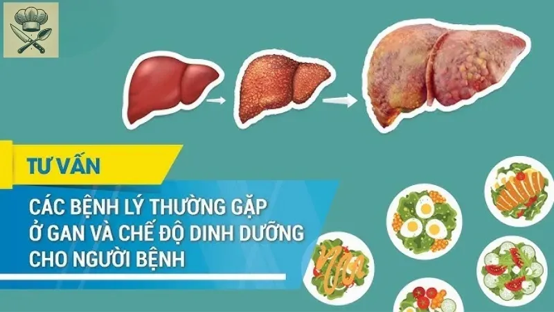 Những thực phẩm tốt nhất trong chế độ ăn cho người bệnh gan mật 4