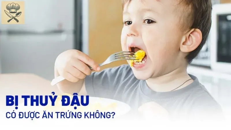 Hướng dẫn xây dựng chế độ ăn cho người bệnh thủy đậu hiệu quả