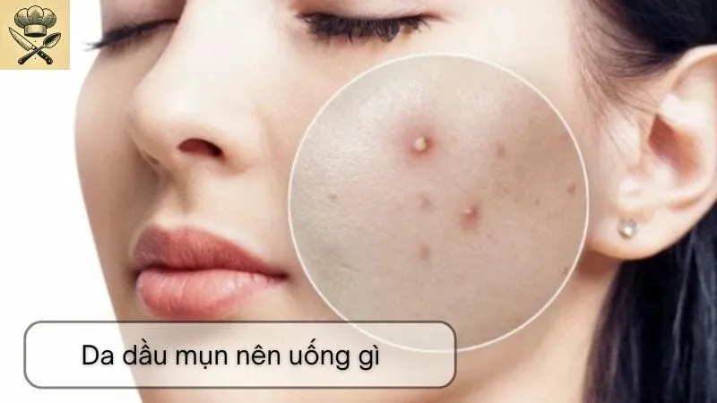 Da dầu mụn nên uống gì - Hướng dẫn cho làn da khỏe đẹp