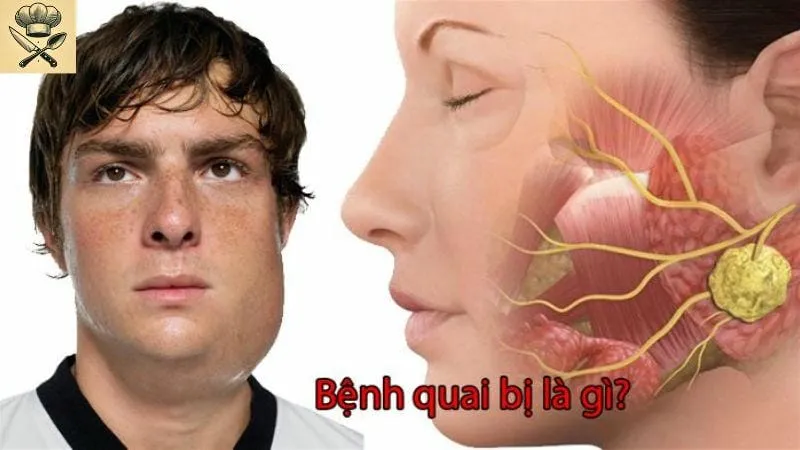 Quai bị uống gì để nhanh khỏi? Hướng dẫn chi tiết và dễ hiểu 1