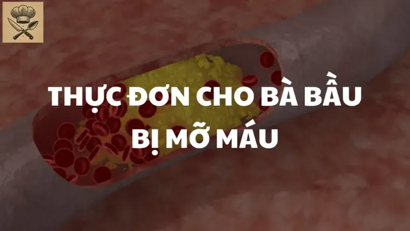 Bà bầu bị mỡ máu nên ăn gì? Gợi ý thực đơn dinh dưỡng hằng ngày