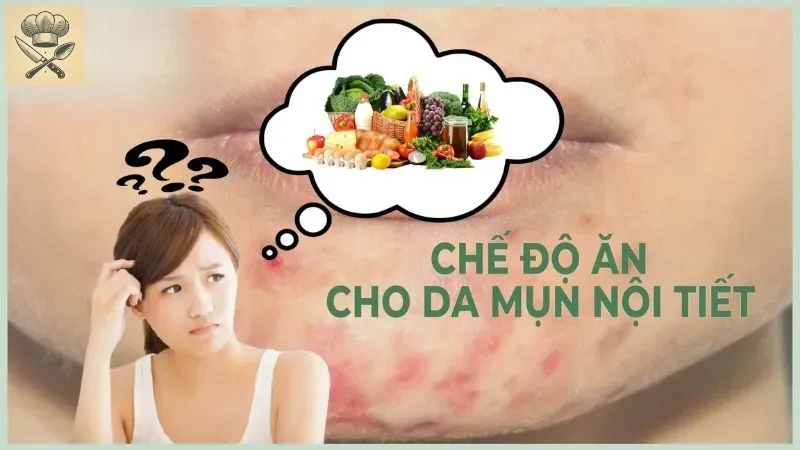 Mẹo xây dựng thực đơn cho người bị mụn nội tiết để làn da khỏe đẹp 2