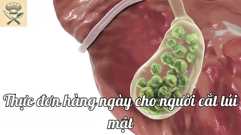 Thực đơn hàng ngày đầy đủ dinh dưỡng cho người cắt túi mật