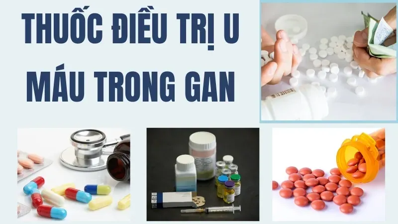 Uống gì giúp tan u máu trong gan nhanh chóng và hiệu quả 2