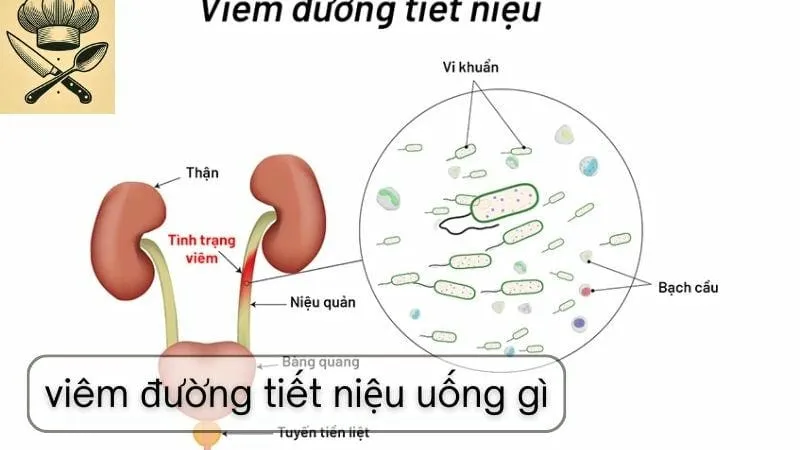 Cách làm đồ uống giúp hỗ trợ điều trị viêm đường tiết niệu