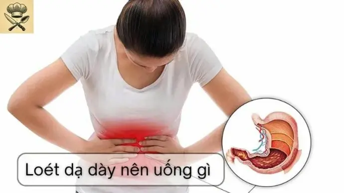 Loét dạ dày uống gì để giảm đau và hỗ trợ phục hồi?