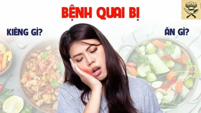 Quai bị kiêng ăn uống gì - Lời khuyên khi mắc quai bị