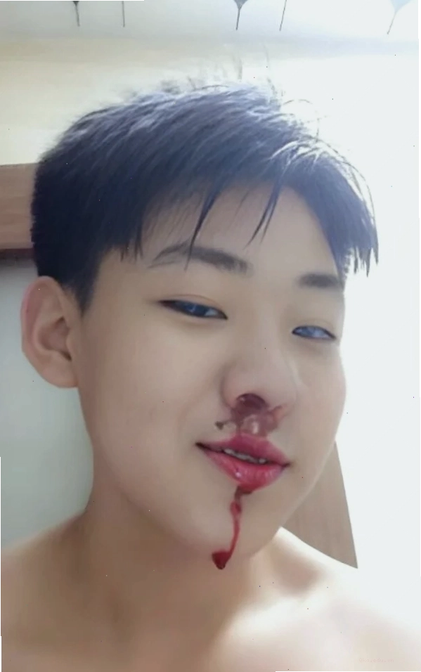 Ảnh meme chảy máu mũi tổng hợp nhiều phiên bản