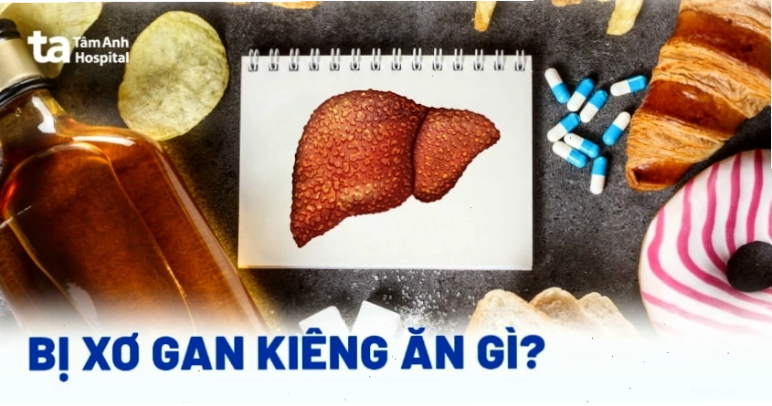 Bị xơ gan kiêng ăn gì, tránh gì để tránh bệnh tiến triển nhanh hơn?