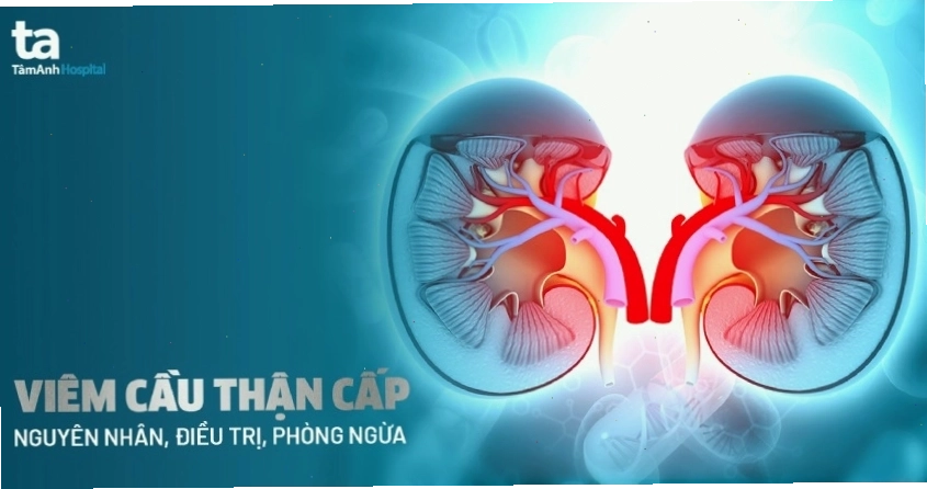 Biểu đồ minh họa triệu chứng và nguyên nhân viêm cầu thận cấp