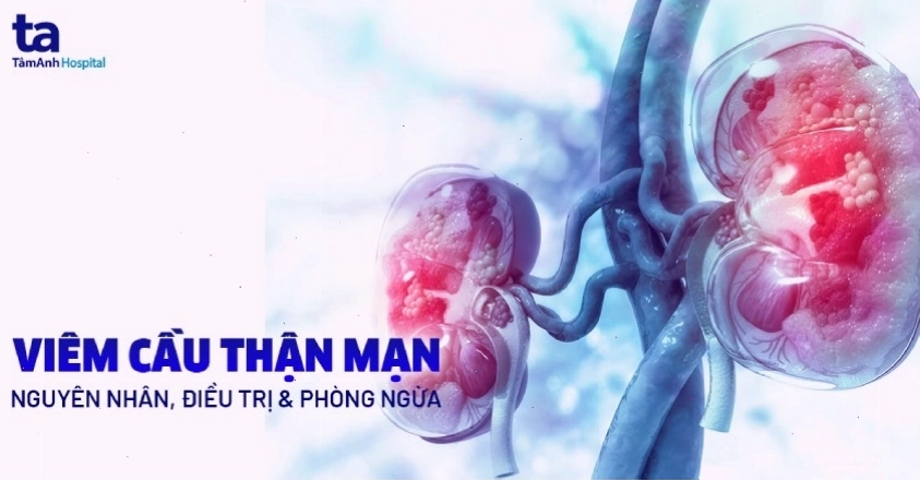 Hình ảnh minh họa biến chứng của viêm cầu thận mạn tính