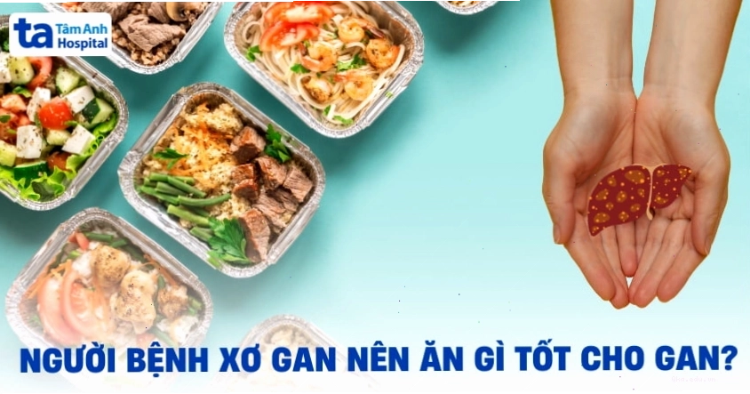 Người bị xơ gan nên ăn gì tốt cho sức khỏe hỗ trợ kiểm soát bệnh?