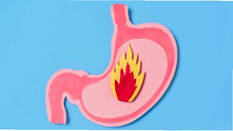 Trào ngược dạ dày xảy ra khi acid từ dạ dày trào ngược lên thực quản